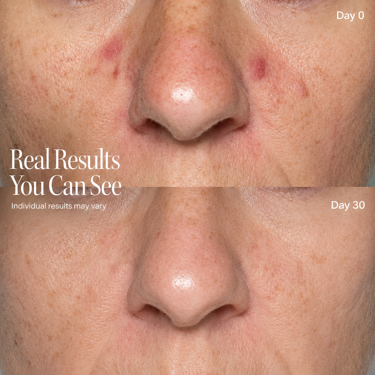Glow Pro Face Mask — photo 4