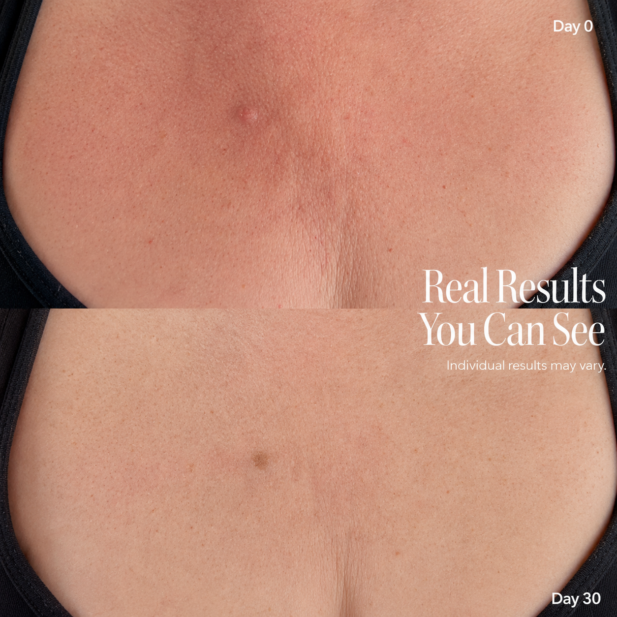 Neck Face Lifter — photo 4